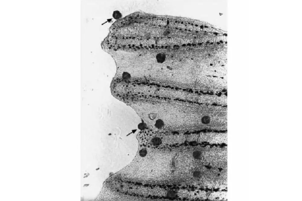 Amyloodinium trophonts in fin