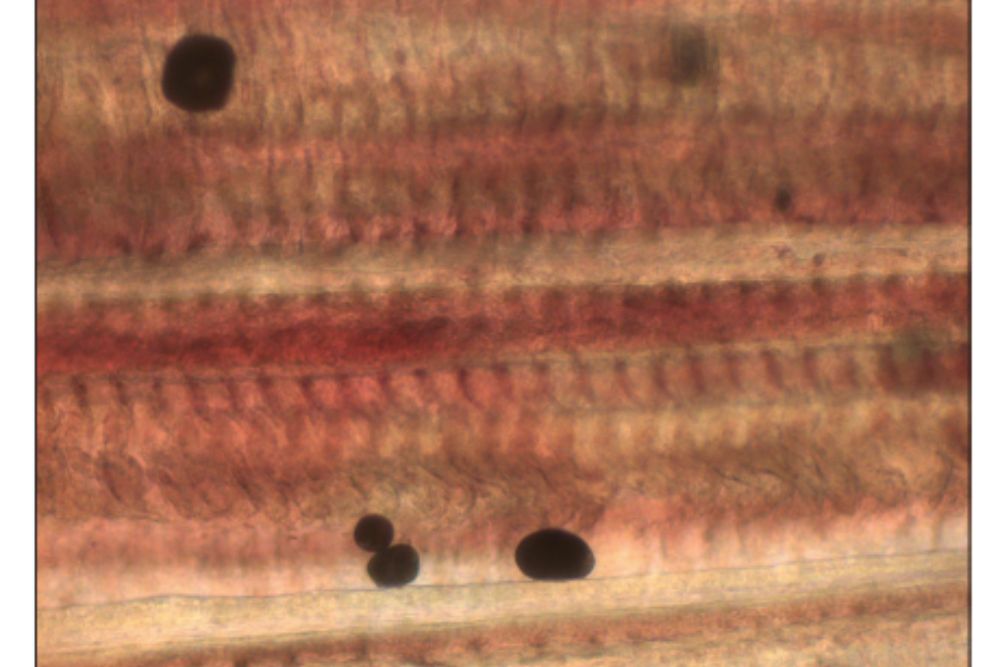 Amyloodinium trophonts on gill tissue