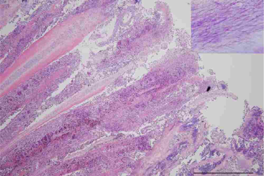 Hemorrhage and severe congestion of the primary gill filaments