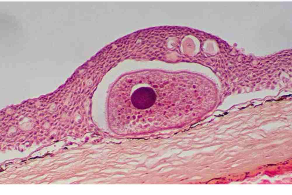 Histological observation of ich on fish skin