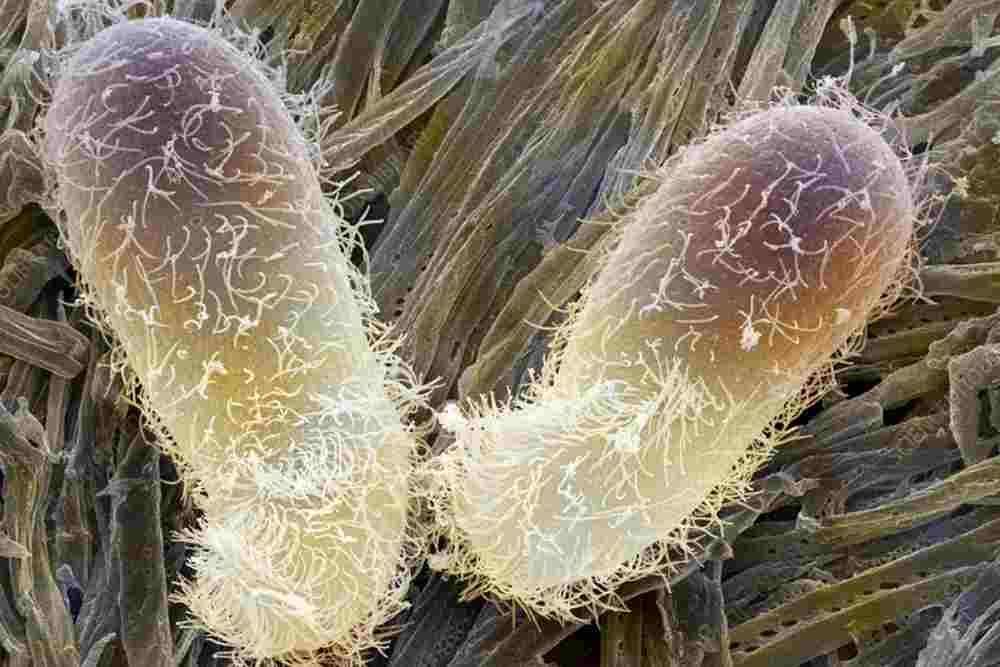 Chilodonella ciliate protozoan